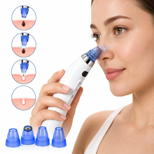 Electric Blackhead Remover Vacuum – Rechargeable Facial Pore Cleaner with Adjustable Suction | She Cosmetics®