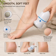 Electric Foot Callus Remover – Rechargeable Foot Grinder & Dead Skin Exfoliator | She Cosmetics®